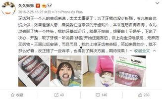 明星网红同款美牙,明星同款笑容养成记