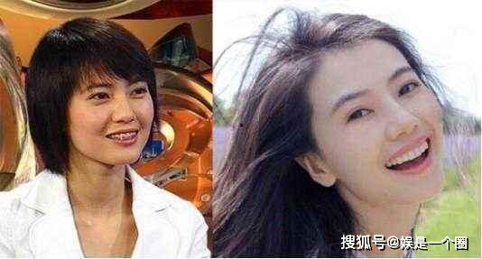 小明星网红戴牙套,美丽蜕变见证口腔健康之路